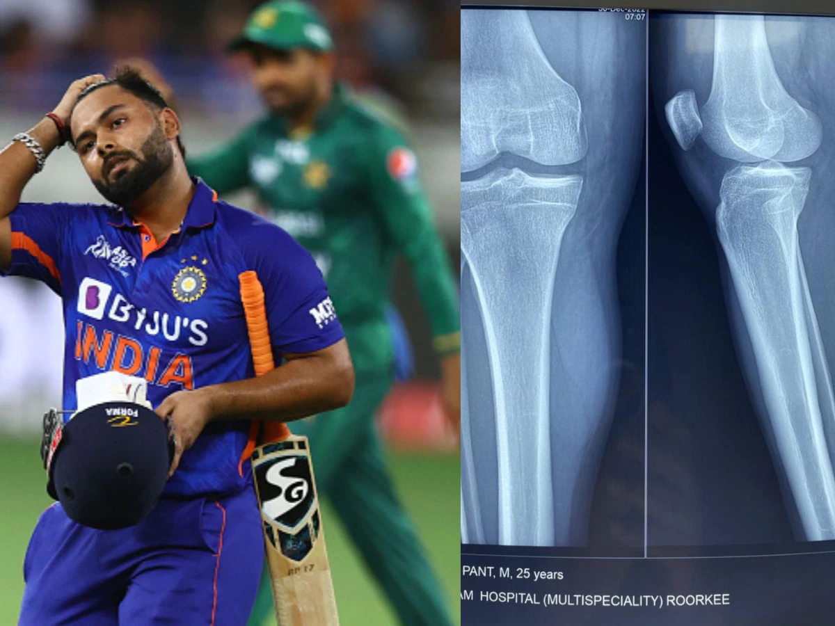 BCCI ON Rishabh Pant Injury